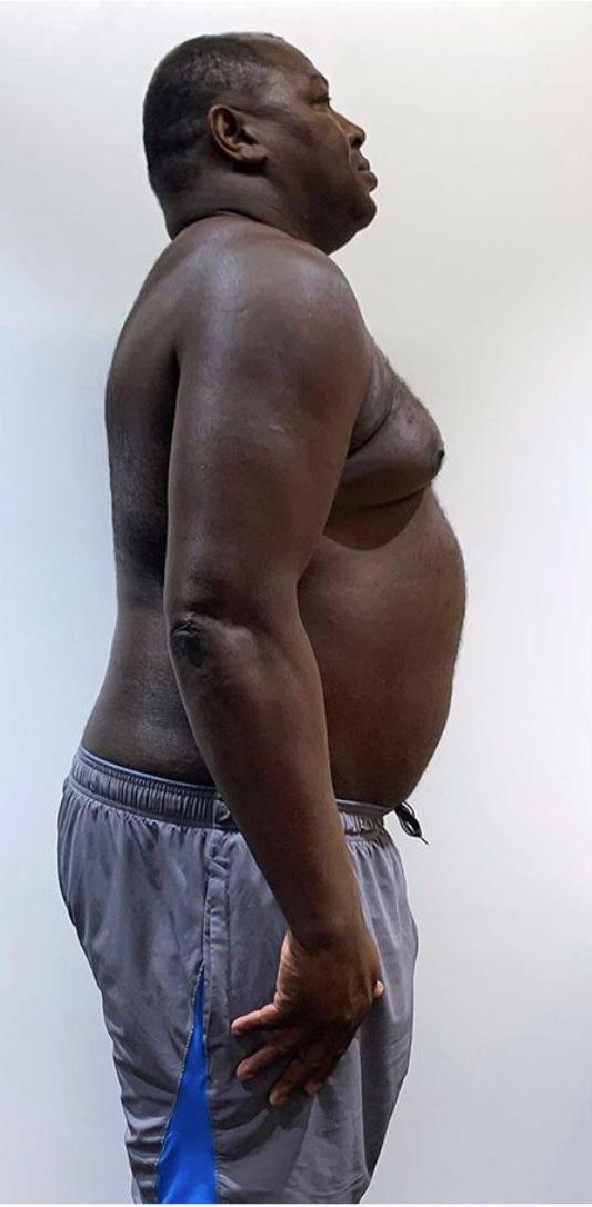 Albert Dwayn Before Transformation